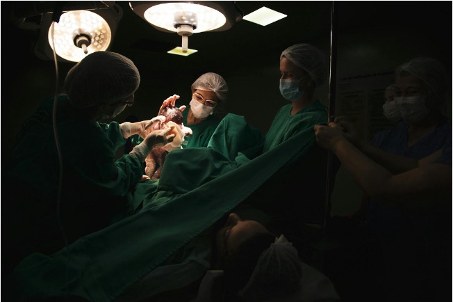 Cesarean section delivery